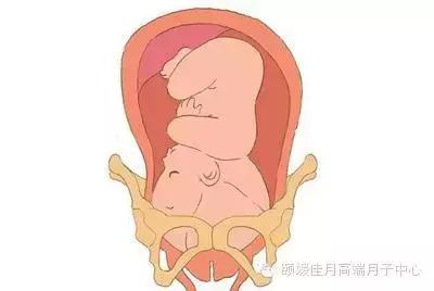 入盆是什么感觉呢？颐媛佳月高端月子会所告诉你