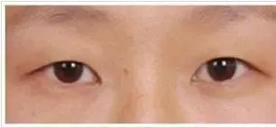 美瞳线和眼线哪个更漂亮一些,美瞳线加宽和画眼线的区别