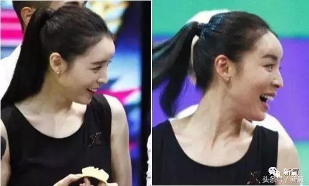 杨紫微整前后容颜对比,杨紫瘦了吗