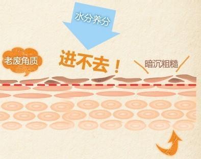 为什么一用贵的护肤品就长痘,为什么你用再贵的产品都没有效果