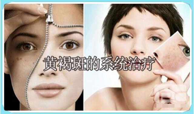 褐青色斑怎么预防,褐青色斑如何预防