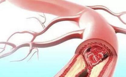 男人不是越硬越好，这4处硬起来反而要当心！