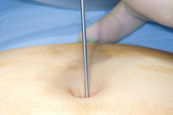 胸闷恶心想吐是什么原因,胸闷气短打嗝恶心想吐怎么回事