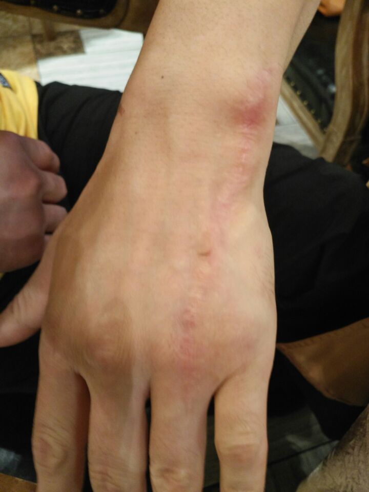 王延龙15秒被ko,王延龙双截棍打架