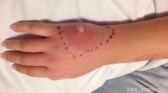 农村动物界的“四大天王”!招惹它们定会让你痛不欲生!