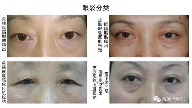 林小宅显老,林小宅算是翻车了吗