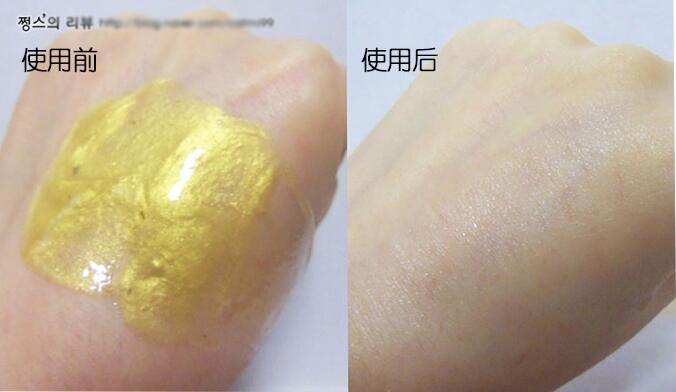 韩国做皮肤多少钱,在韩国大概一天要花多少钱