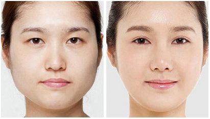 最快最有效的科学瘦脸方法,瘦脸最好的锻炼方法