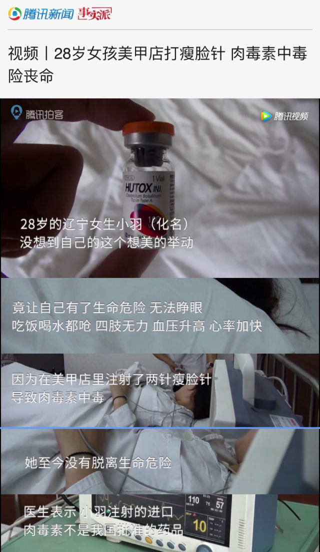 肉毒素中毒是医生的问题吗,肉毒素的常见问题答复