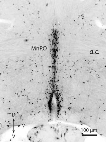 渴、渴、渴，口渴的神经基础被发现｜前沿