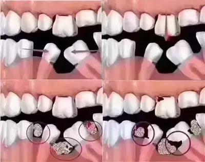 满嘴牙齿松动发疼是怎么回事,早上起床牙齿松动怎么回事