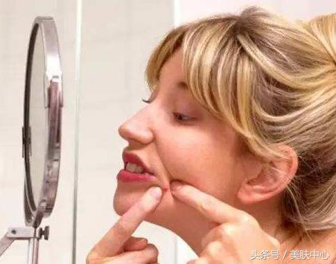 如何去掉下巴的痘痘痕迹,长期下巴痘痘去除小妙招