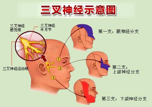 健康——武汉市中心医院王潞教你解决“天下第一痛”