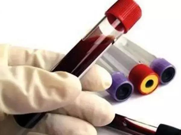 血常规指标全都偏低,血常规哪个指标看肝