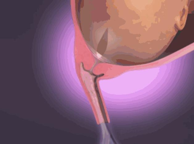 女人生孩子有多痛和疼,生小孩到底有多痛图文