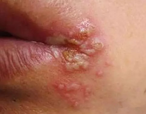 一周岁宝宝怎么预防口腔疾病,孩子的口腔健康要从小呵护