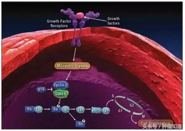 esmo乳腺癌最新研究进展,国外乳腺癌研究现状