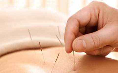 国医大师贺普仁针灸心法丛书,国医大师贺普仁针灸视频