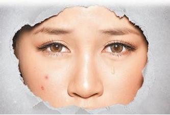 专业医学级别的激素脸（激素皮炎）四步疗法