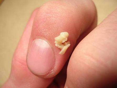 从小到大口臭的厉害,从小到大口臭特别重