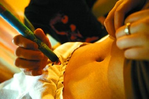 艾灸灸过的反应,艾灸后灸痕分析