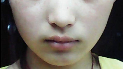 你的脸为什么会一边大一边小,新生儿的脸一边大一边小如何矫正