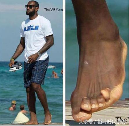 那些职业选手不为人知的事,运动员那些不为人知的事