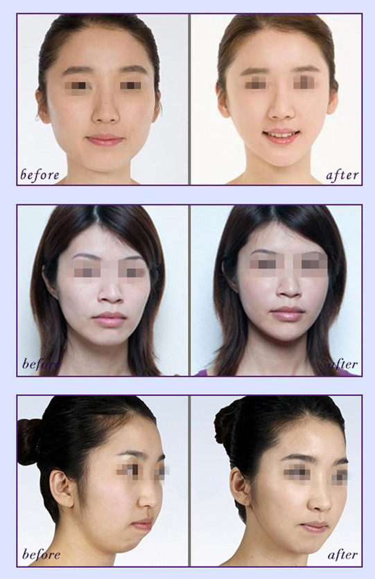 你眼里的丑也许是别人眼里的美,为什么别人很美而自己很丑