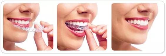 牙缝大的人漏财,牙缝变大有漏财说法吗