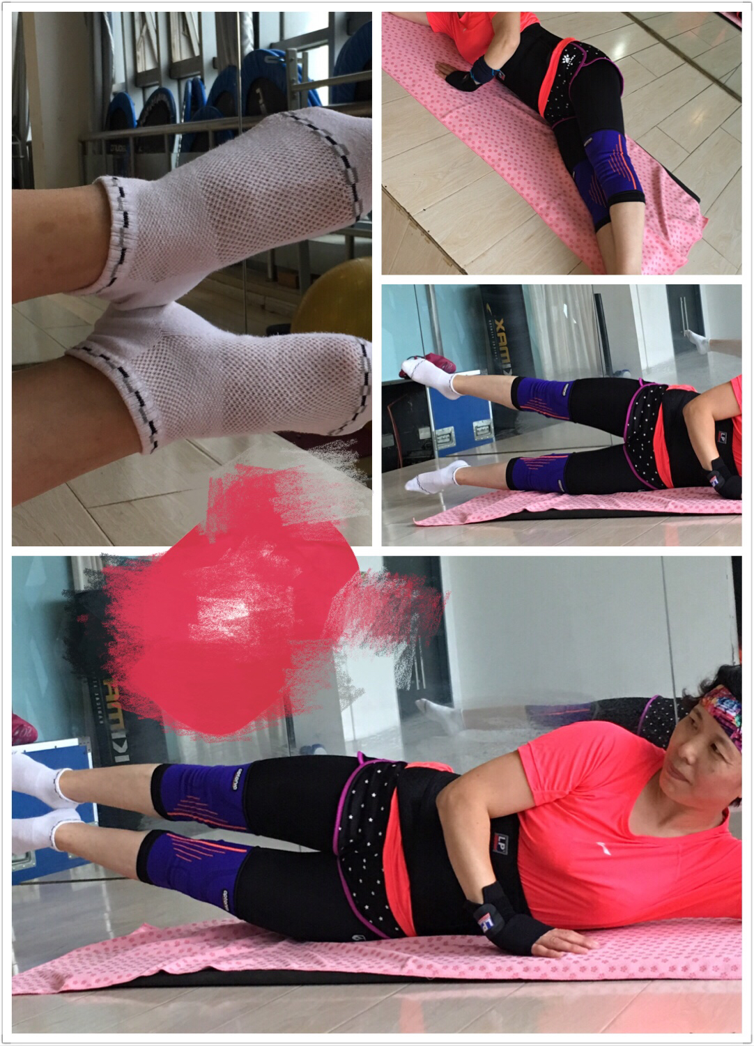 o型腿矫正训练,o型腿怎么矫正健身