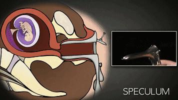 人流对生娃有什么影响,人流跟生孩子哪个危害更大