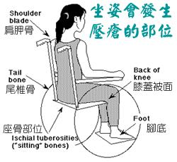 压疮的普及,压疮演变