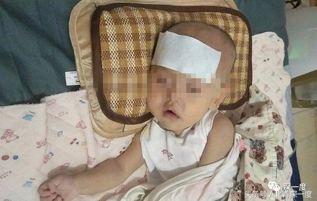 庞贝氏症这种病严重吗,庞贝氏症2018