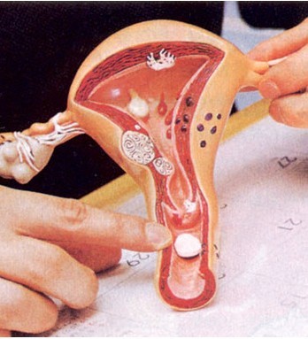 生孩子到预产期没动静该怎么办,孕产遇到的各种问题