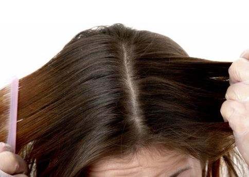 头皮干燥是不是就会脱发,头皮干燥会影响生长吗