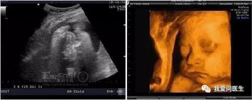 孕期超声知识app,孕期超声那些事ppt