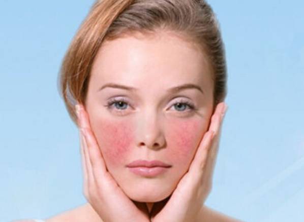 越补水越干？刺痛泛红统统找上来，关于皮肤屏障你需要知道的事！