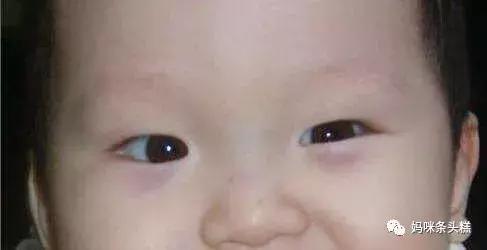 黄帝内经眼袋描述,黄帝内经中讲怎样让眼袋去掉