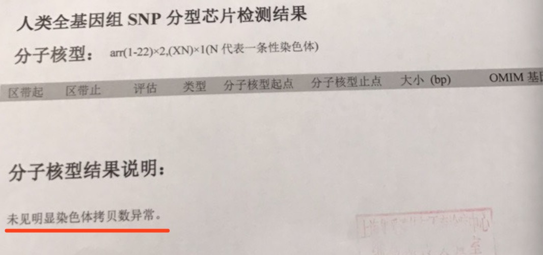 怀孕26周四维检查医生说小肠扩张,肠管扩张的宝妈