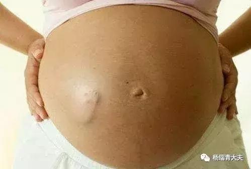 孕妈妈要注意的事情,孕妈妈感觉胎动可怕怎么办