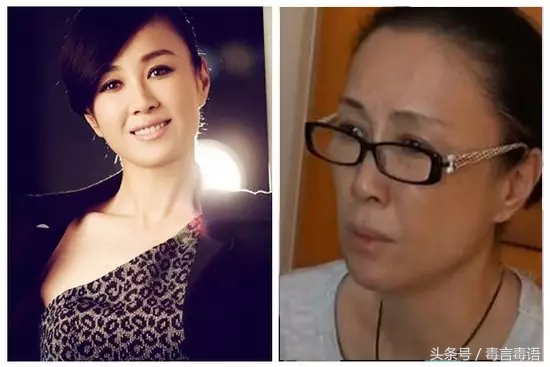 吸毒前后的变化对比,吸毒真的会毁容吗