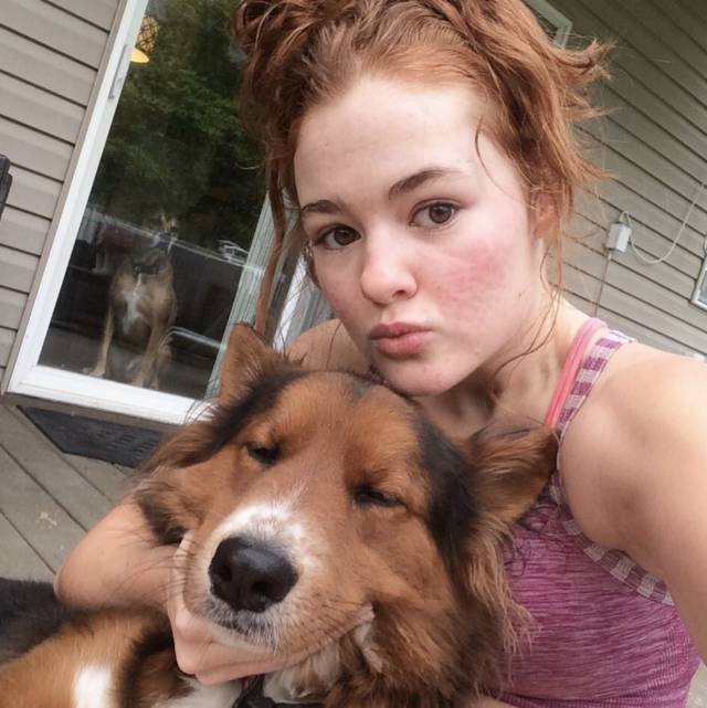 360°真实记录从满脸痘到痊愈，她红遍了Ins