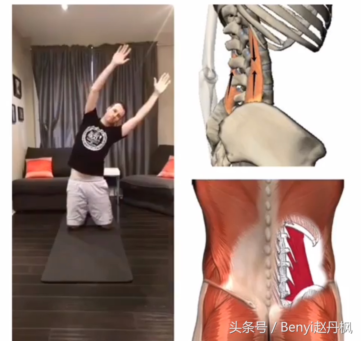 减缓腰椎疼痛的药,减缓腰椎间盘突出疼痛的按摩手法