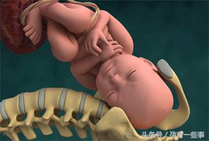脐带异常，孕妈妈的必备知识