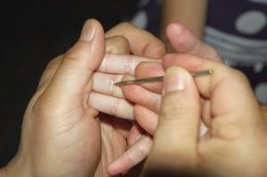 腹痛，疳积，月经不调，咽痛咳嗽，经外一奇穴一招灵