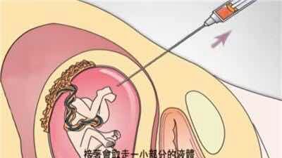 怀孕期间怎么避免唐氏儿,如何避免唐氏儿