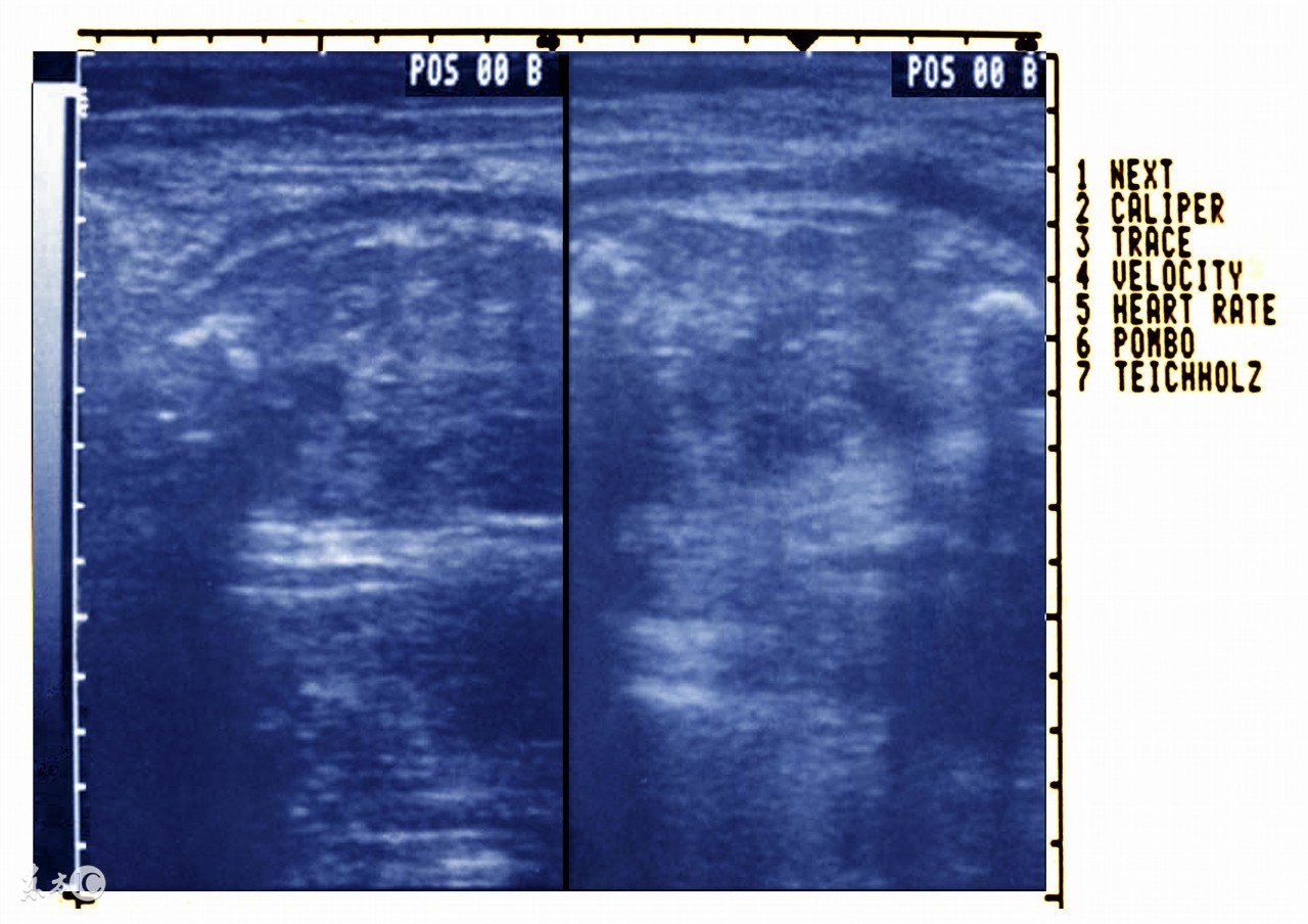 羊水为什么叫羊水秒懂知识,羊水是怎么产生的为什么羊水少
