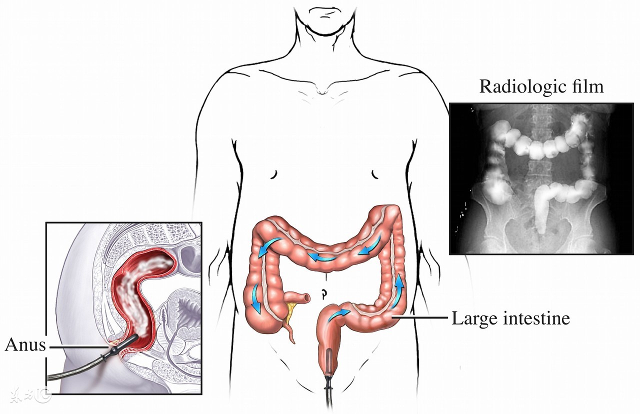 经常憋屁怎么缓解,经常憋大便的补救措施