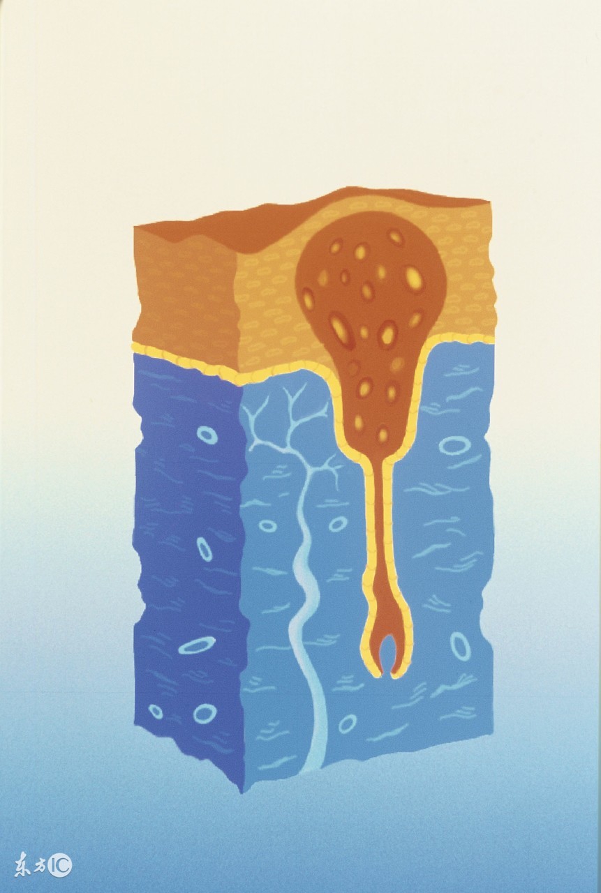 金银花泡水喝治皮肤痒吗,长疖子能喝金银花泡水吗