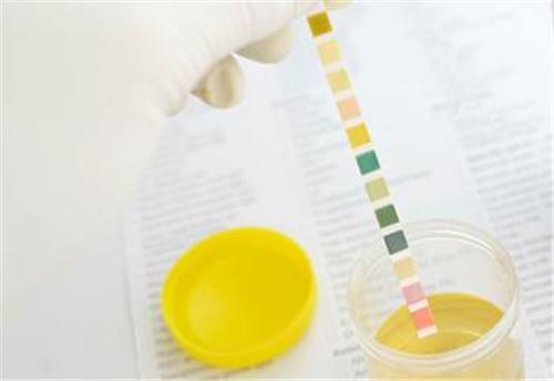 尿路感染突然尿血疼痛一直想拉尿,尿快尿完了感觉疼痛是尿路感染吗